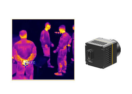 Ungekühltes 384x288 17μM Thermal Imaging Camera für medizinische Anwendungen